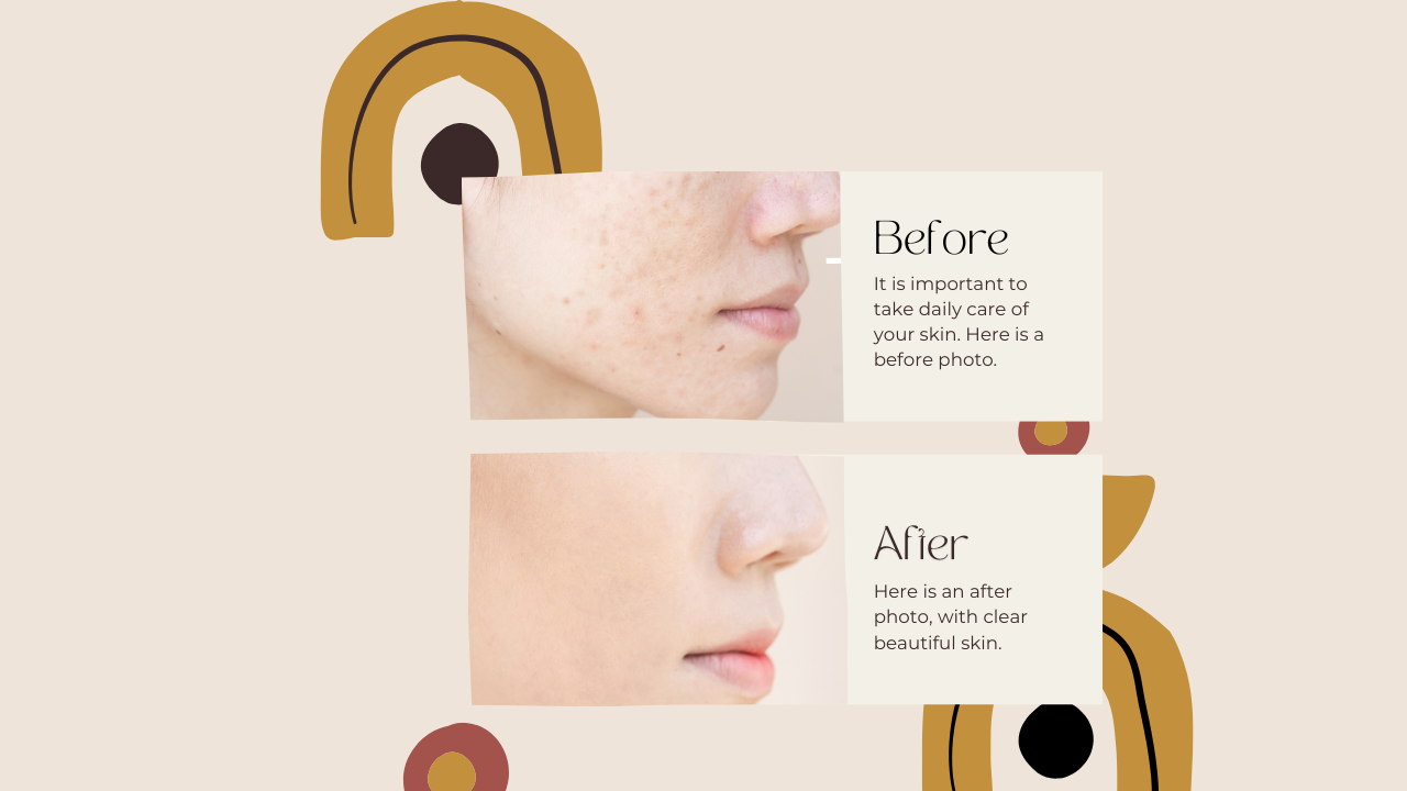 before and after skin 